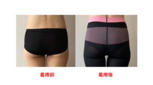 メディキュット 着用beforeafter 後ろ