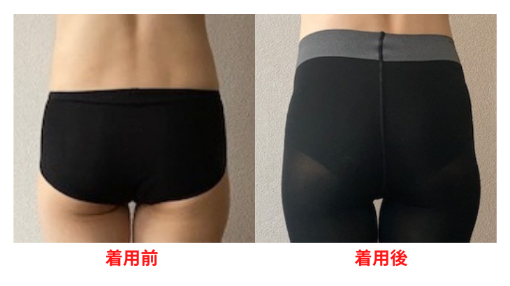 ライザップbeforeafter back