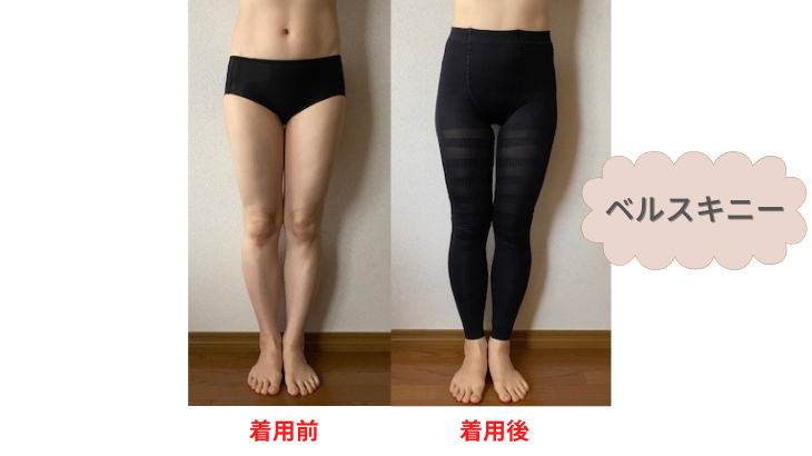 ベルスキニー beforeafter 正面